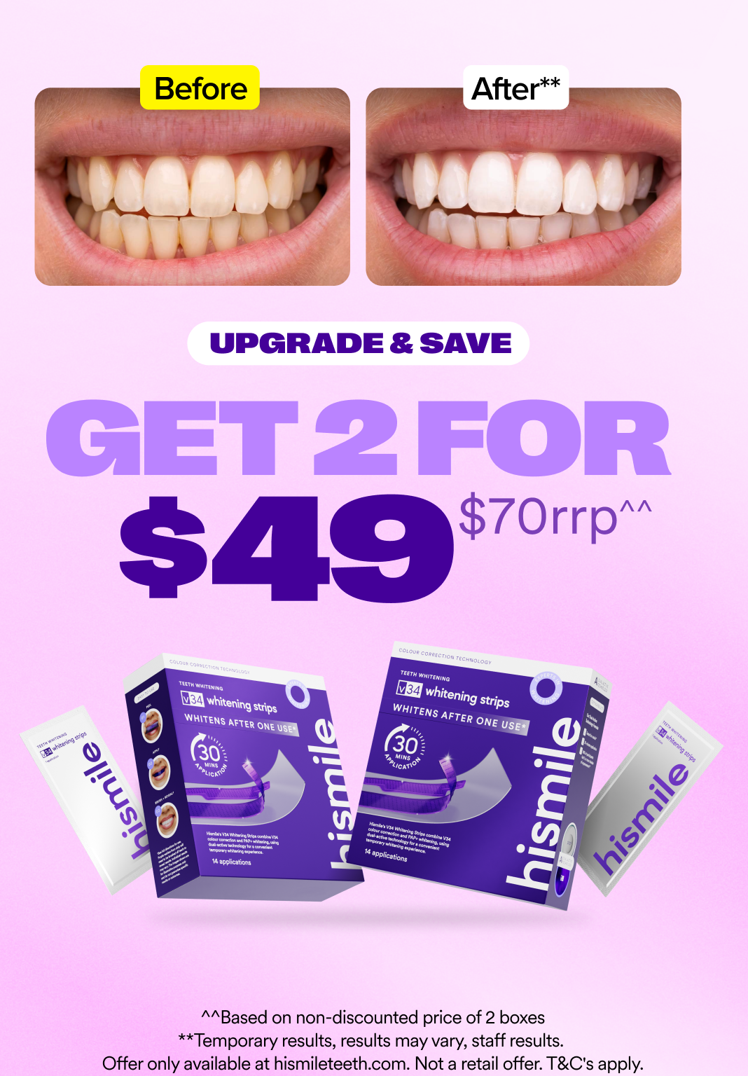 V34 Whitening Strips - Value 2 Pack