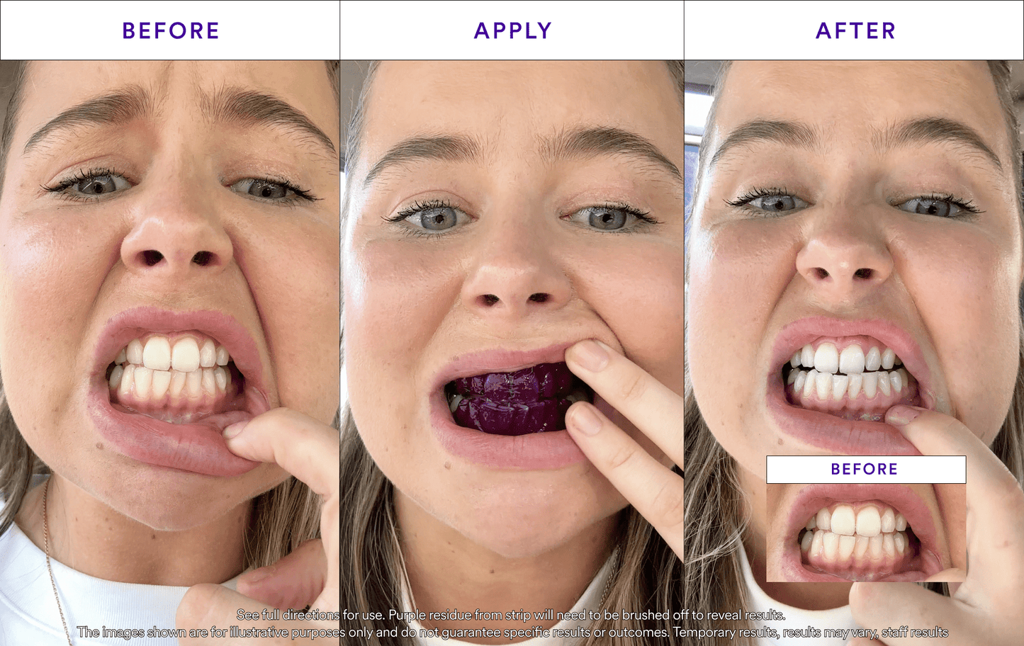 Buy 2 Get 1 Free - V34 Whitening Strips